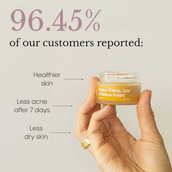 The Complete Acne System for Women