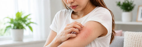 Relief for Dry, Itchy Skin: What Calms It Fast and What Actually Lasts