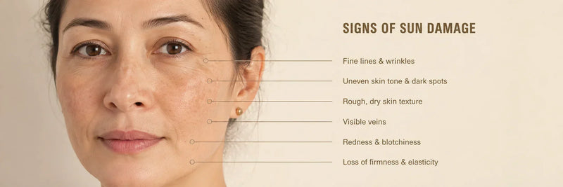 How to Repair Sun-Damaged Skin (Mature Skin Edition)