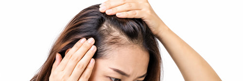 Natural Scalp and Hair Growth Routine: A Scalp-First Guide for Women Over 40