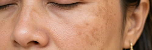 Sun Damage on Face: What's Reversible (and What's Not)
