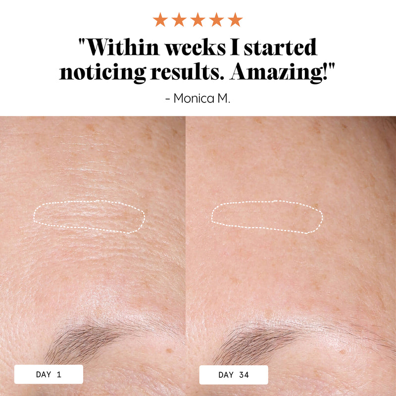 Frøya Organics Anti-Age & Insane Glow Day Balm glass jar close-up showing product label and size