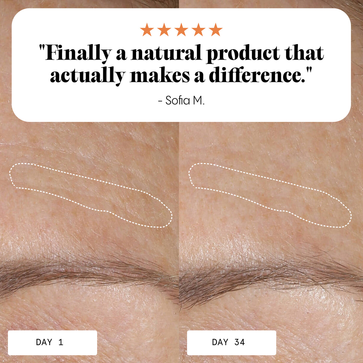 Anti-Aging Tagesbalsam für jugendliches Strahlen