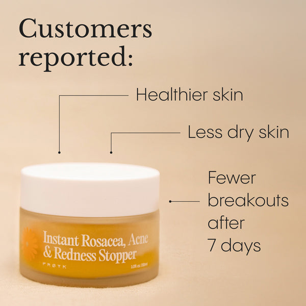 Balm for Acne-Prone Skin