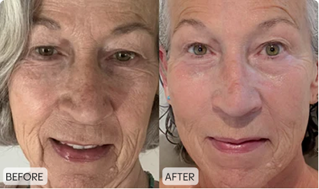 Customer before and after