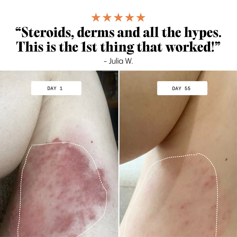 Frøya Organics Ultra-Fast Relief Balm glass jar close-up showing product label and size