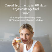 Before and after skin improvement with Frøya Organics Instant Rosacea, Acne & Redness Stopper