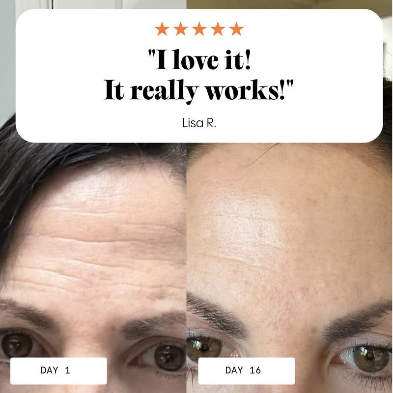 Frøya Organics Magic Wrinkle Eraser Night Balm glass jar close-up showing product label and size