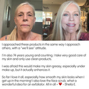 Customer review of Frøya Organics Complete System for Mature Women's Skin showing before and after results