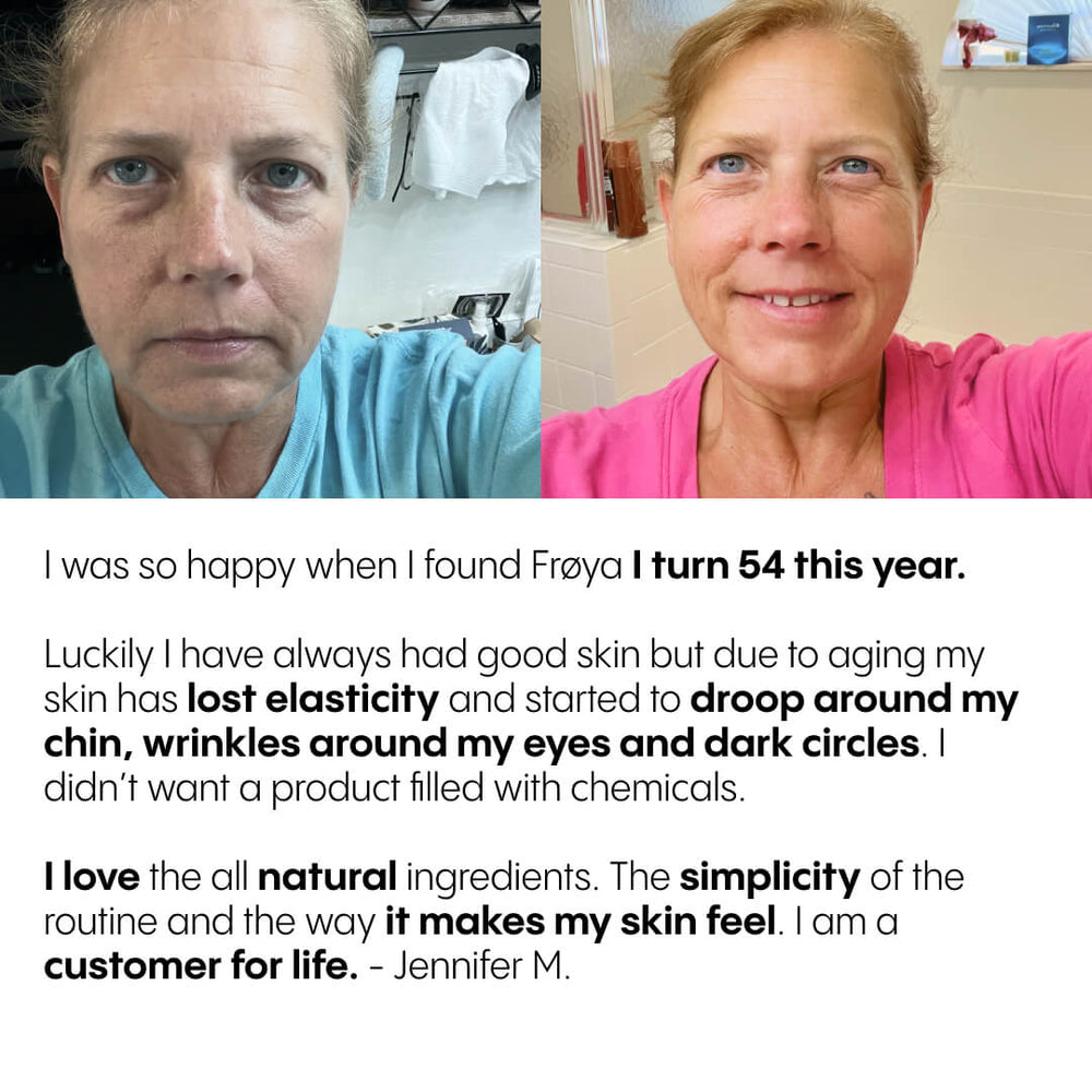 Customer review of Frøya Organics Complete System for Mature Women's Skin by Jennifer showing skin improvement