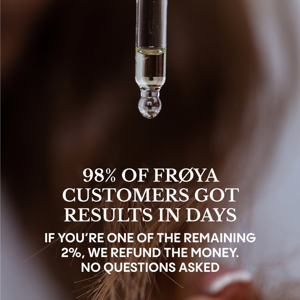 Hair growth progress results with Frøya Organics hair system