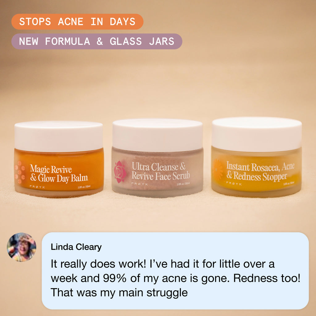 Skincare product jars with acne treatment labels and a testimonial overlay.