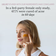 Frøya Organics Complete Acne System for Women 100% satisfaction money-back guarantee badge