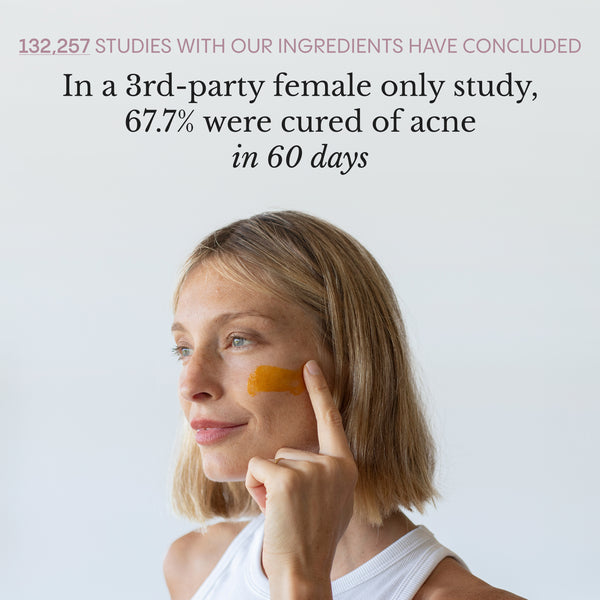 The Complete Acne System for Women