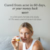 The Complete Acne System for Women