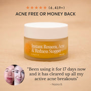 Frøya Organics Complete Acne System for Women additional product details and customer results