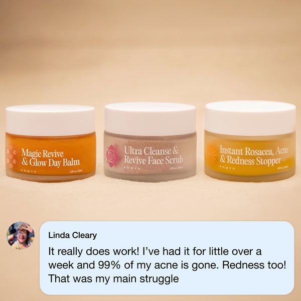 The Complete Acne System for Women