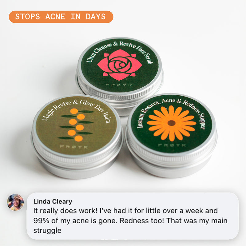 The Complete Acne System for Women | Frøya Organics