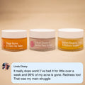 The Complete System for Acne-Prone Skin