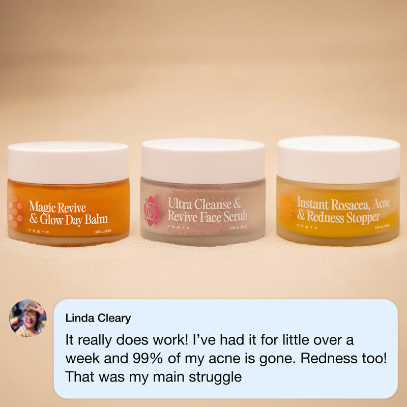 Frøya Organics Complete System for Acne-Prone Skin in glass jar with lid – front view