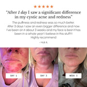 Système Complet pour Peau à Imperfections