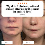 Frøya Organics Ultra Cleanse & Revive Face Scrub – organic face scrub by Frøya Organics
