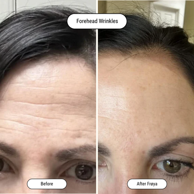 Before and after result