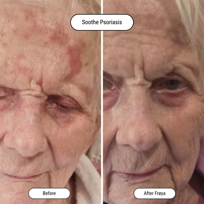 Before and after result