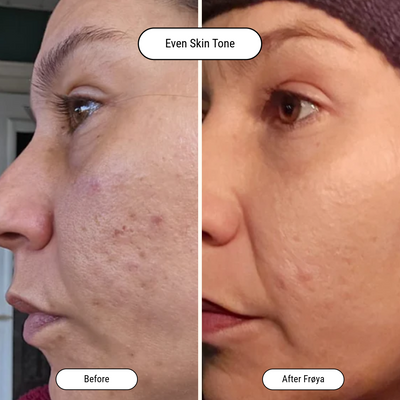 Before and after result