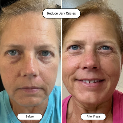 Before and after result