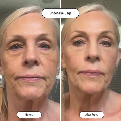 Before and after result