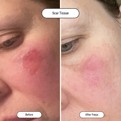 Before and after result