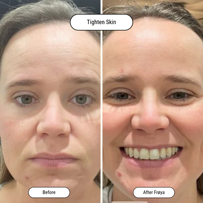 Before and after result