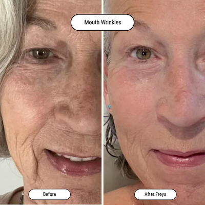 Before and after result