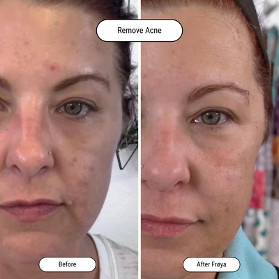 Before and after result