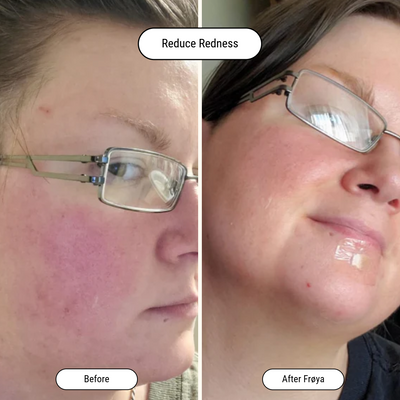 Before and after result