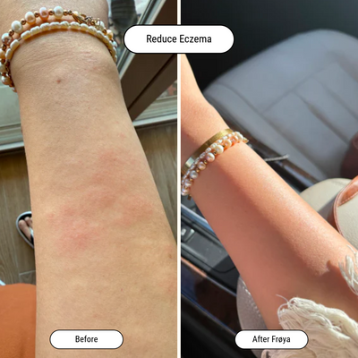 Before and after result