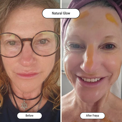 Before and after result