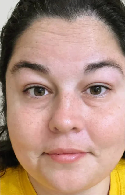 Trial participant 1 after 60 days