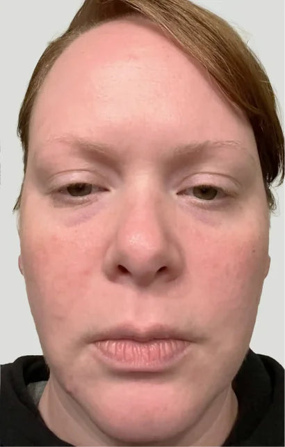 Trial participant 3 after 60 days