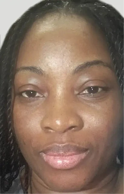 Trial participant 4 after 60 days