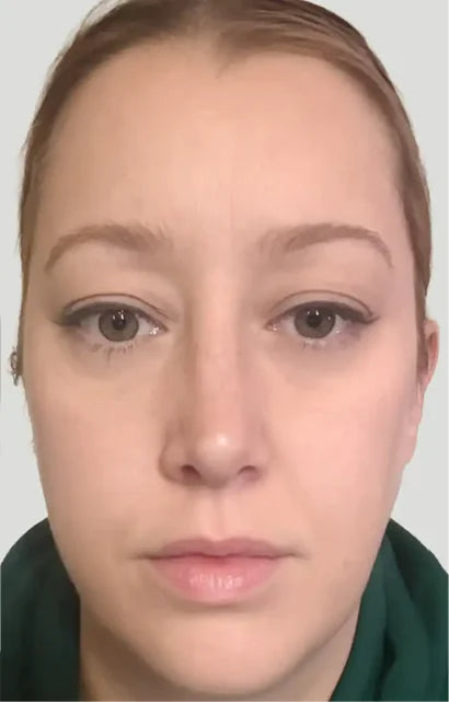 Trial participant 6 after 60 days