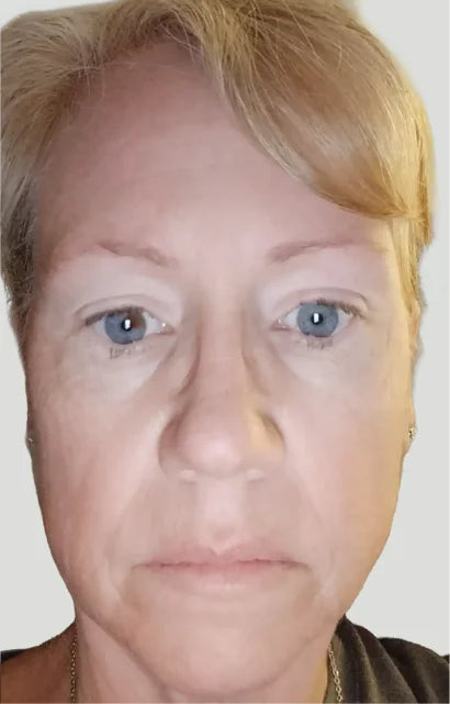 Trial participant 7 after 60 days