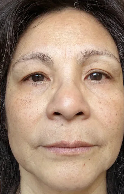 Trial participant 8 after 60 days