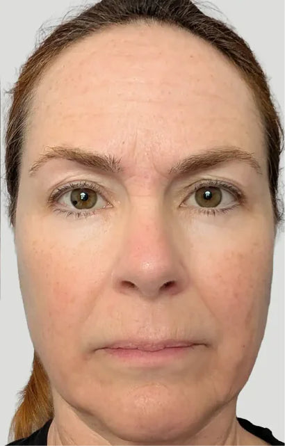 Trial participant 9 after 60 days