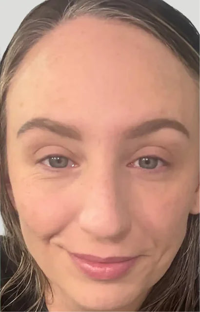 Trial participant 10 after 60 days