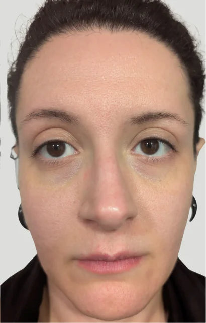 Trial participant 11 after 60 days