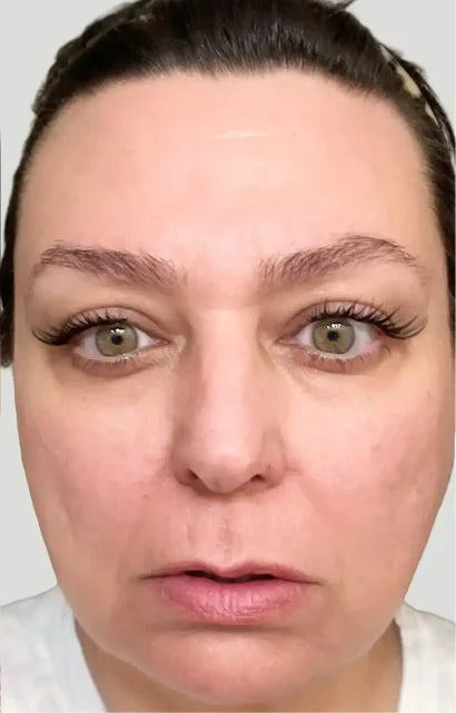 Trial participant 12 after 60 days