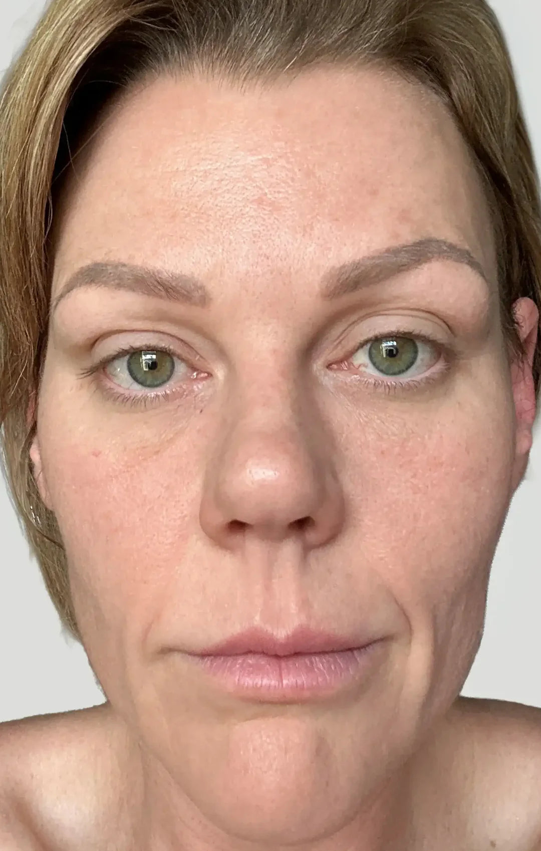 The same participant after 60 days