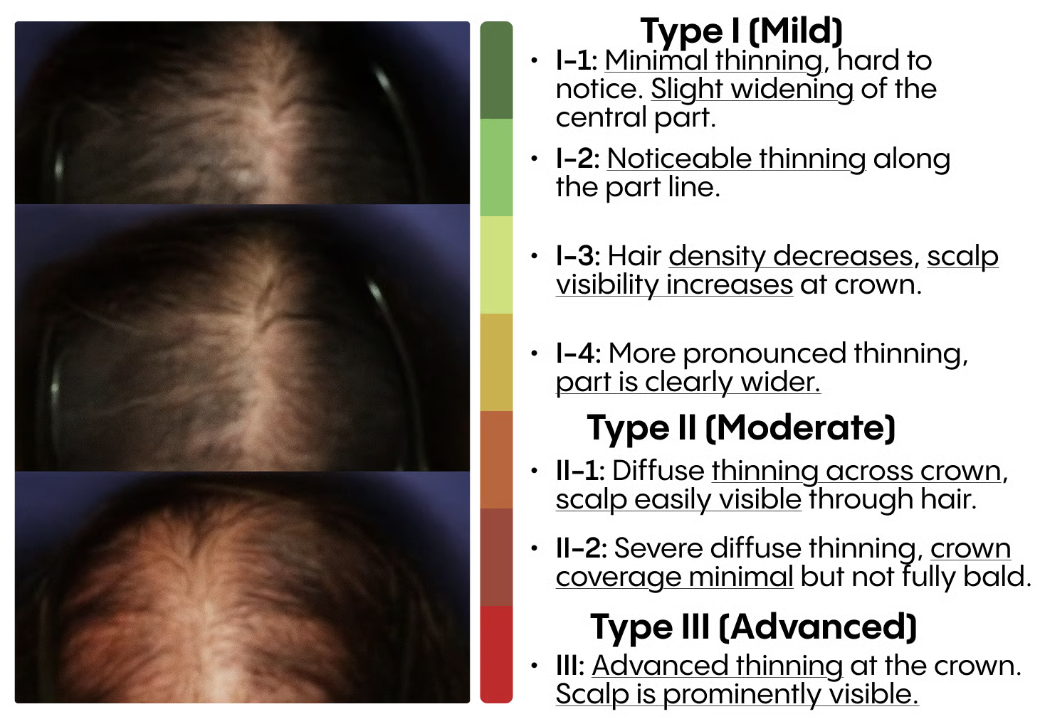 Comparison of scalp images across Ludwig Scale stages with color swatches